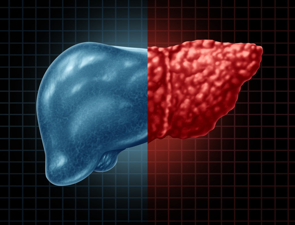 Fatty Liver Disease Now Affects 4 in 10 US Adults - Camelicious USA